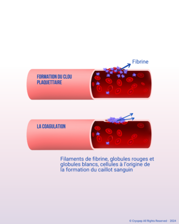 Quest-ce-que-lhemostase-3