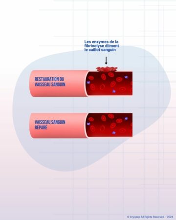 La fibrinolyse