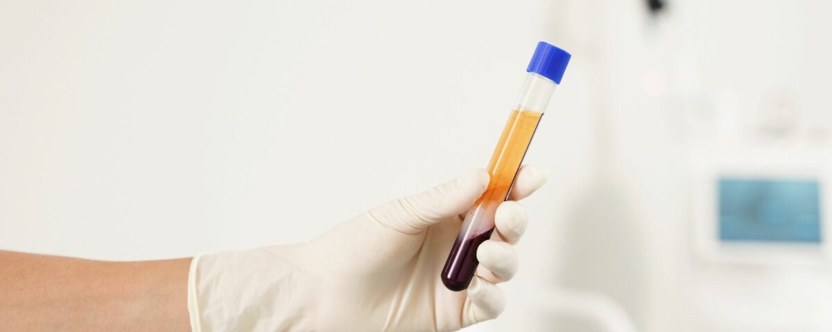 Services 1 Quest ce que le plasma cryopep
