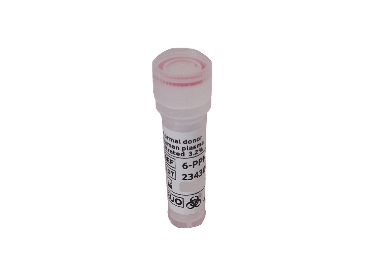 Image_6-PPNDCI_Plasma_Normal_citraté_donneur_sain.jpg